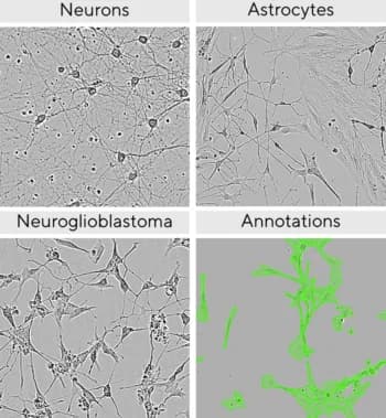 Kaggle competition image for Sartorius - Cell Instance Segmentation