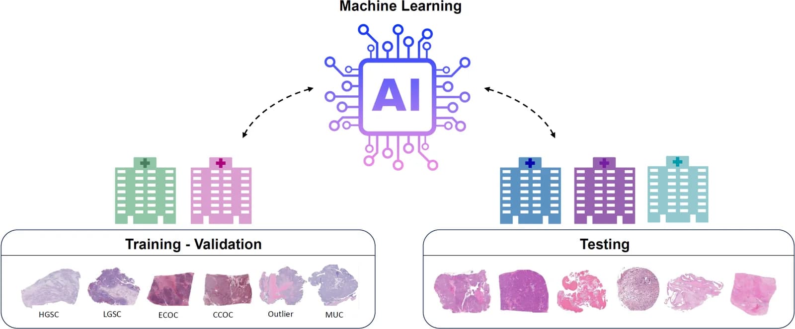 Kaggle competition image for UBC Ovarian Cancer Subtype Classification and Outlier Detection (UBC-OCEAN)