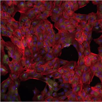 Kaggle competition image for Recursion Cellular Image Classification