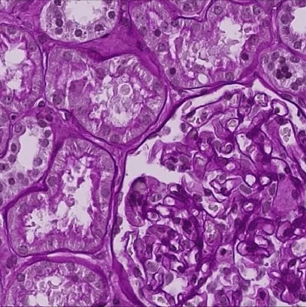 Kaggle competition image for HuBMAP - Hacking the Human Vasculature