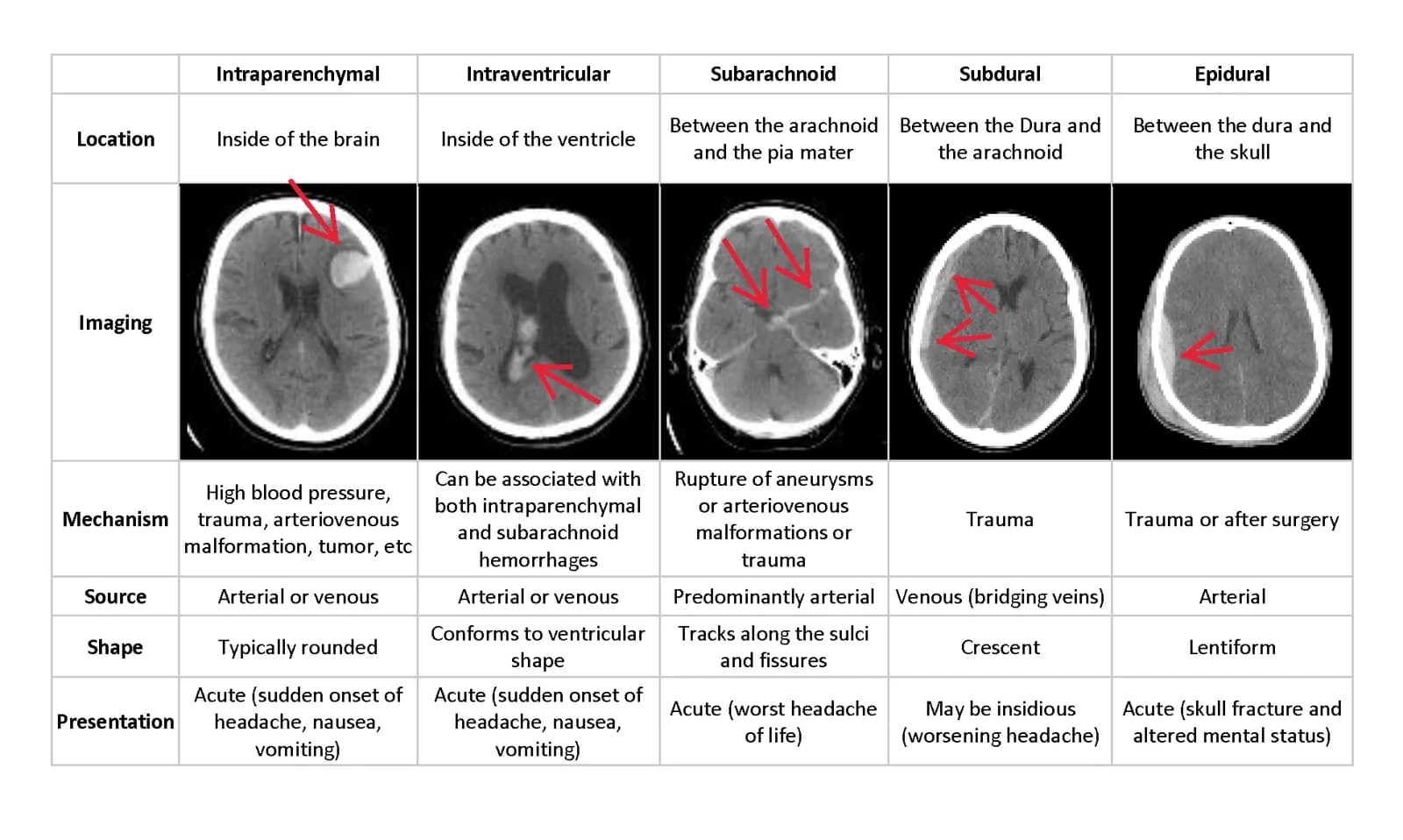 Kaggle competition image for RSNA Intracranial Hemorrhage Detection