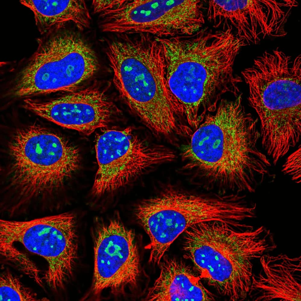 Kaggle competition image for Human Protein Atlas Image Classification