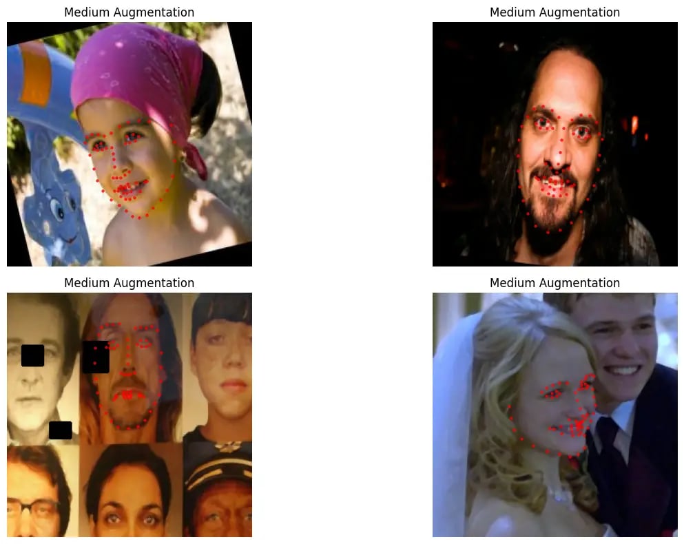 Medium augmentation examples